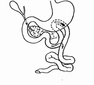 Этюды желудочной хирургии