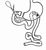 Этюды желудочной хирургии