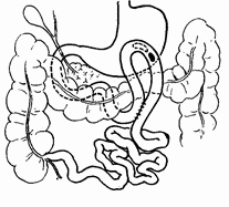 Этюды желудочной хирургии