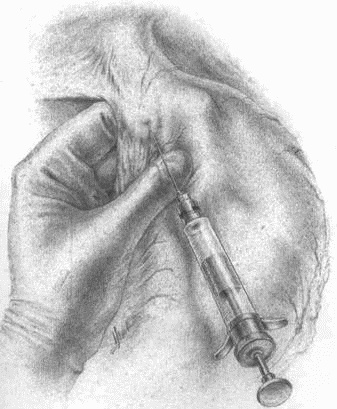 Этюды желудочной хирургии