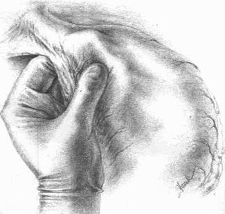 Этюды желудочной хирургии