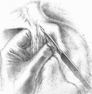 Этюды желудочной хирургии