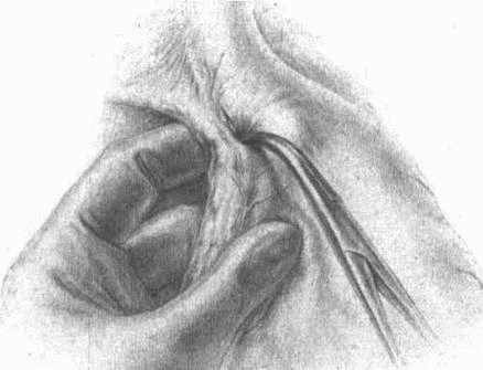 Этюды желудочной хирургии