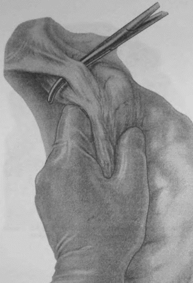 Этюды желудочной хирургии