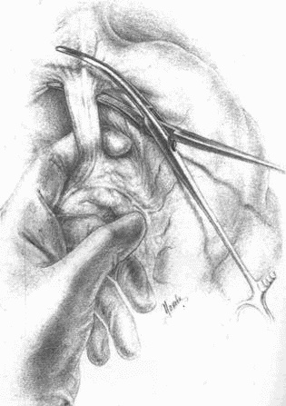 Этюды желудочной хирургии