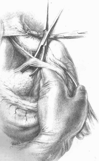 Этюды желудочной хирургии