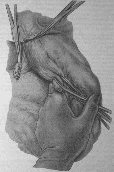 Этюды желудочной хирургии