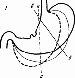 Этюды желудочной хирургии