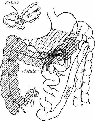 Этюды желудочной хирургии