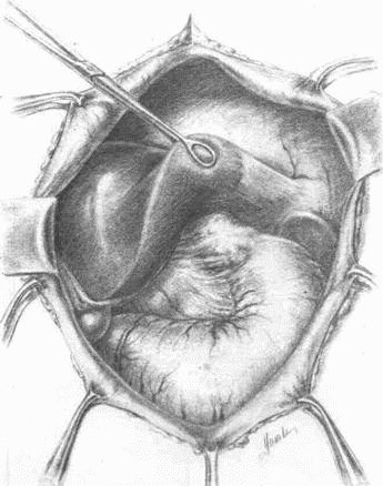 Этюды желудочной хирургии
