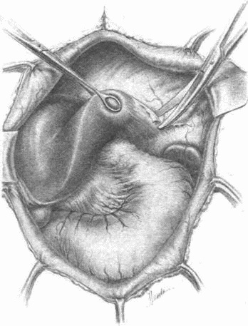 Этюды желудочной хирургии