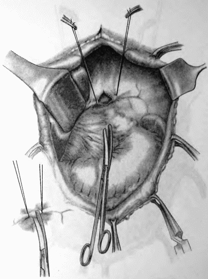 Этюды желудочной хирургии