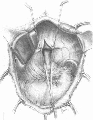 Этюды желудочной хирургии