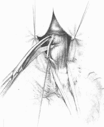 Этюды желудочной хирургии
