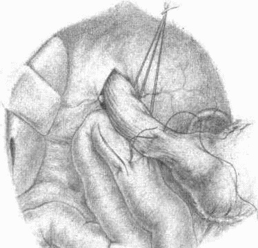 Этюды желудочной хирургии