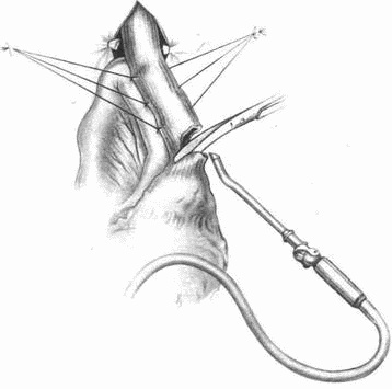 Этюды желудочной хирургии