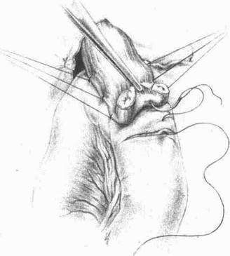 Этюды желудочной хирургии