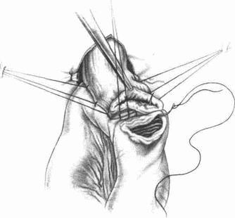 Этюды желудочной хирургии