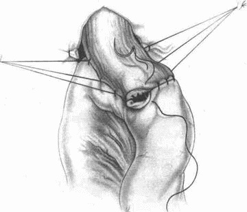 Этюды желудочной хирургии