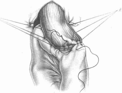 Этюды желудочной хирургии