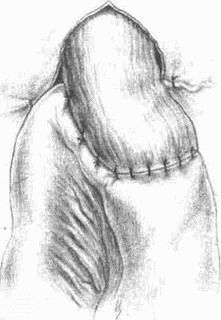 Этюды желудочной хирургии