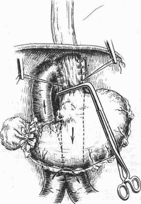 Этюды желудочной хирургии