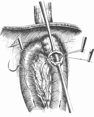 Этюды желудочной хирургии