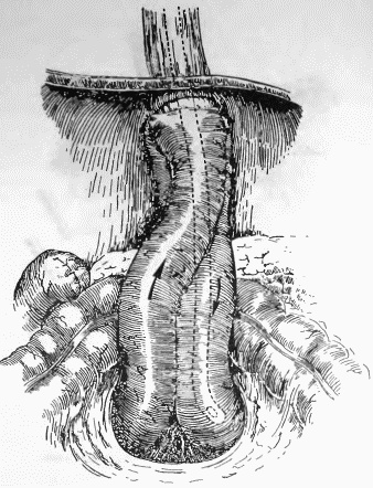 Этюды желудочной хирургии