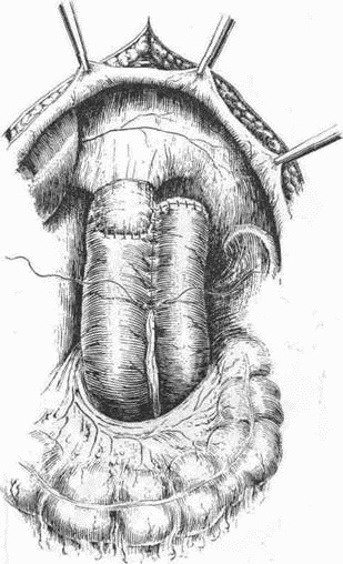 Этюды желудочной хирургии