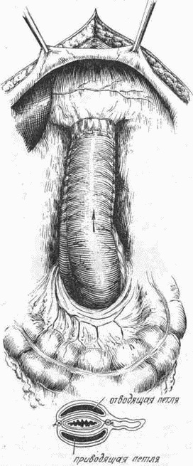 Этюды желудочной хирургии