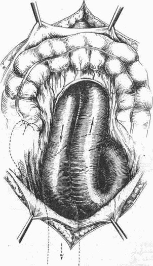 Этюды желудочной хирургии