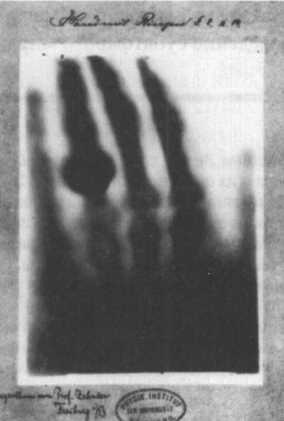 Темная сторона материи. Дирак. Антивещество