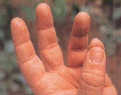 36,6 градусов. Искусство оставаться в живых!