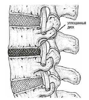 Настольная книга для тех, у кого болит спина