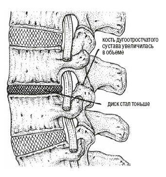 Настольная книга для тех, у кого болит спина