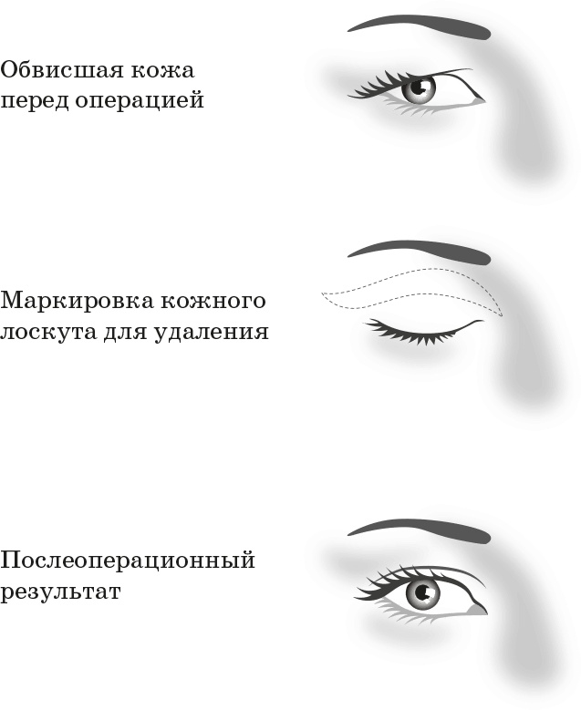 Как обмануть возраст Как обмануть возраст