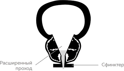 Мужское здоровье. Как у вас с ним?