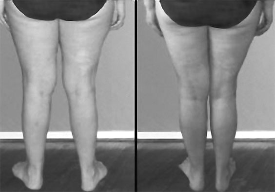 Система Осьмионика. Самомоделирование осанки. Коррекция верхней половины тела