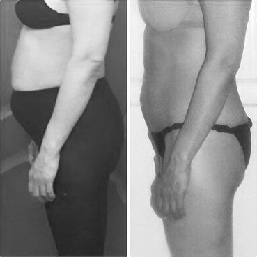 Система Осьмионика. Самомоделирование осанки. Коррекция верхней половины тела