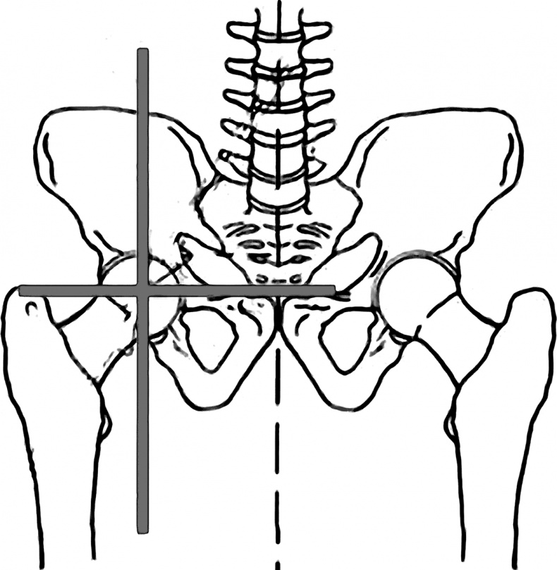 Система Осьмионика. Самомоделирование осанки. Коррекция верхней половины тела Система Осьмионика. Самомоделирование осанки. Коррекция верхней половины тела