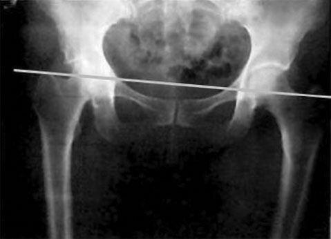 Система Осьмионика. Самомоделирование осанки. Коррекция верхней половины тела Система Осьмионика. Самомоделирование осанки. Коррекция верхней половины тела