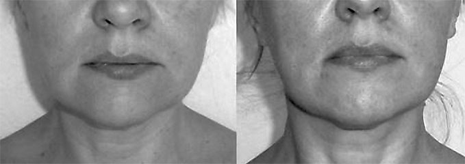 Система Осьмионика. Самомоделирование осанки. Коррекция верхней половины тела Система Осьмионика. Самомоделирование осанки. Коррекция верхней половины тела