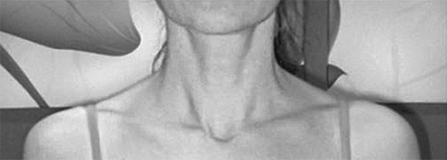 Система Осьмионика. Самомоделирование осанки. Коррекция верхней половины тела Система Осьмионика. Самомоделирование осанки. Коррекция верхней половины тела