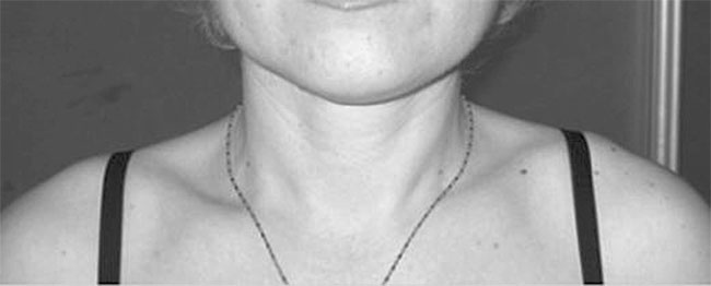 Система Осьмионика. Самомоделирование осанки. Коррекция верхней половины тела Система Осьмионика. Самомоделирование осанки. Коррекция верхней половины тела