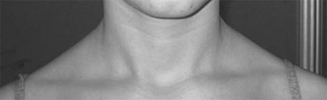 Система Осьмионика. Самомоделирование осанки. Коррекция верхней половины тела Система Осьмионика. Самомоделирование осанки. Коррекция верхней половины тела