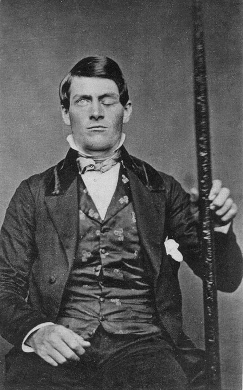 Мозговодство Мозговодство