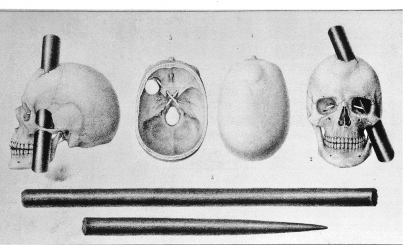 Мозговодство Мозговодство